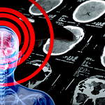 PTSD é Também uma Doença Física! 4 PTSD - é também uma Doença Física